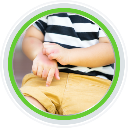 Stretch marks can be helped with Bepanthen Stretch Mark Cream