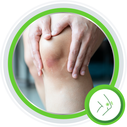 Understand Skin Bruises