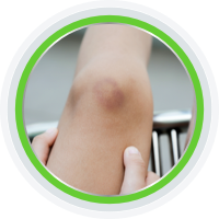 knee pain